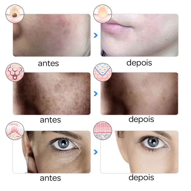 Máscara de Fototerapia Facial – Rejuvenescimento da Pele e Tratamento Antiacne