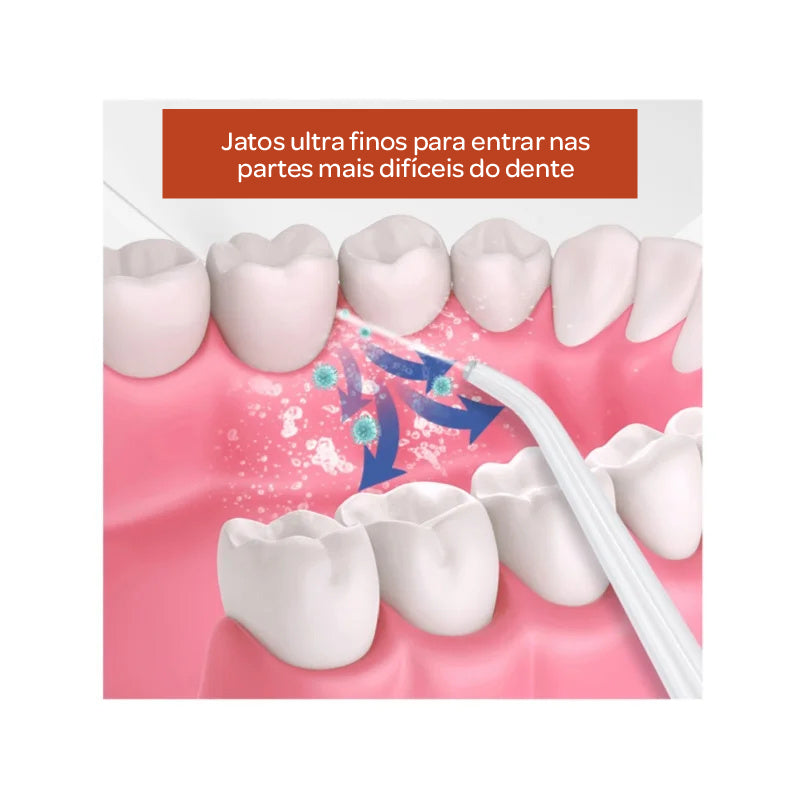 Irrigador Bucal Recarregável USB | Limpeza Profunda e Sem Dor